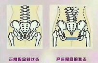 蓝丝带盆底肌修复大概需要多少钱？