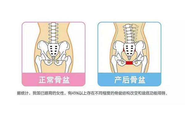 产后恢复加盟