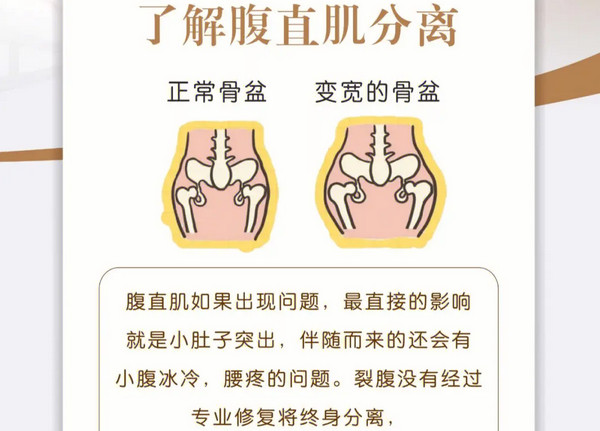 产后修复需要做吗到底有没有用？_4